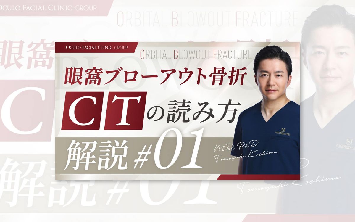 CTの読み方の解説